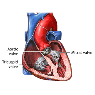 Mitral Valve Regurgitation